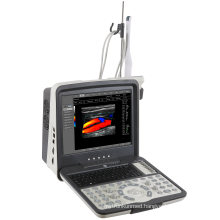 3D Ultrasound Scanner Machine 2 Probe Connector Full Digital Portable 15inch PC Based Laptop 3dB Ultrasound B Scanner